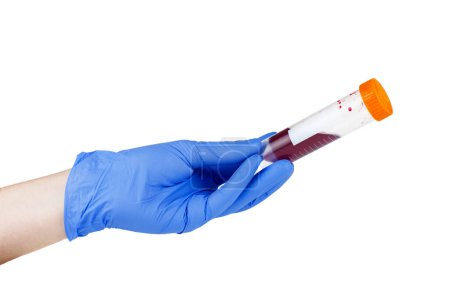 Téléchargez les photos : Tenir la main tube à essai en plastique avec du sang sur un fond blanc - en image libre de droit