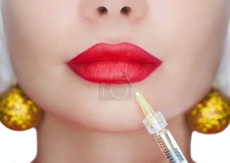 Téléchargez les photos : Le cosmétologue fait l'injection de toxine botulique sur les lèvres d'une belle jeune femme. Concept Nouvel An et cosmétologie - en image libre de droit
