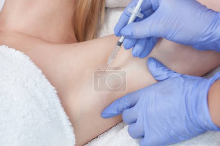 Téléchargez les photos : Le médecin fait des injections intramusculaires de toxine botulinique dans la région des aisselles contre l'hyperhidrose. - en image libre de droit