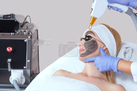 Téléchargez les photos : Procédure d'épluchage du visage en carbone dans un salon de beauté. Matériel traitement de cosmétologie. - en image libre de droit