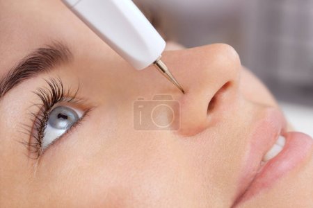 Téléchargez les photos : Le cosmétologue fait la procédure de traitement de Couperose de la peau du visage d'une belle, jeune femme dans un salon de beauté.. - en image libre de droit