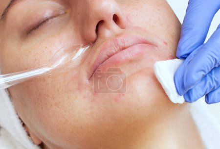 Foto de El cosmetólogo realiza el procedimiento Terapia microactual de la piel facial de una hermosa mujer joven en un salón de belleza. Cosmetología y cuidado profesional de la piel. - Imagen libre de derechos