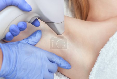 Photo for The cosmetologist does the laser hair removal procedure in the armpit zone, to a young woman in a beauty salon. - Royalty Free Image