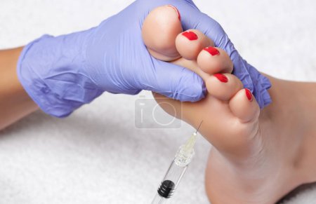 Téléchargez les photos : There is a woman's foot, a cosmetologist is making intramuscular injections of on the feet of a woman against hyperhidrosis in a beauty salon. - en image libre de droit