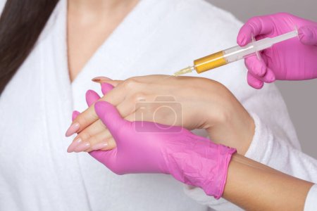 Téléchargez les photos : Le médecin fait des injections de toxine botulique sur les paumes d'une femme contre l'hyperhidrose et sur la peau des mains contre les rides. Cosmétologie féminine, soins de la peau. - en image libre de droit