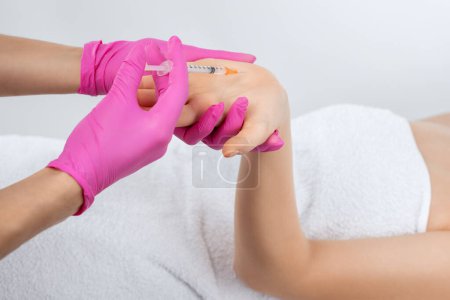 El cosmetólogo realiza inyecciones de toxina botulínica en las palmas de las manos de una mujer contra la hiperhidrosis. Cosmetología femenina, cuidado de la piel.
