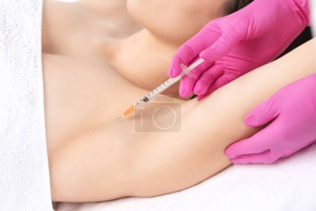 Le médecin fait des injections de toxine botulinique dans la région des aisselles contre l'hyperhidrose. Concept de cosmétologie féminine.