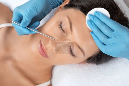 Photo for A procedure for cleansing the skin of the face from blackheads and acne. Cosmetologist treats problematic skin of a young woman's face in a beauty salon. Aesthetic cosmetology and makeup concept. - Royalty Free Image