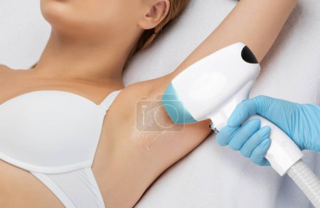 epilation hair removal procedure on a womans body. Beautician doing laser rejuvenation in a beauty salon. Removing unwanted body hair. Hardware ipl cosmetology