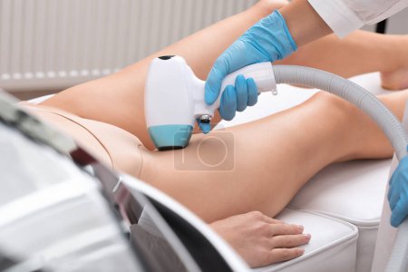 Epilation Haarentfernung am Körper einer Frau. Kosmetikerin bei einer Laserverjüngung am Unterschenkel in einem Schönheitssalon. Entfernen unerwünschter Körperbehaarung. Hardware IPL Kosmetologie