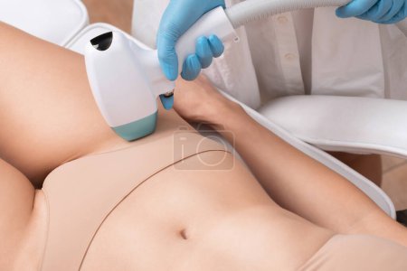 Epilation Haarentfernung am Körper einer Frau. Kosmetikerin bei einer Laserverjüngung am Unterschenkel in einem Schönheitssalon. Entfernen unerwünschter Körperbehaarung. Hardware IPL Kosmetologie
