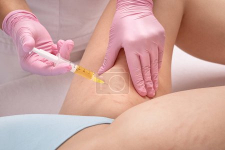 Téléchargez les photos : L'esthéticienne fait des injections de plasma sanguin sur les cuisses d'une femme. Traitement des vergetures cutanées à la clinique. - en image libre de droit