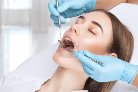 Ein Zahnarzt behandelt Karies am Zahn einer jungen schönen Frau in einer Zahnklinik. Zahnfüllung.