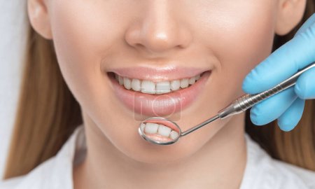 Ein Zahnarzt behandelt Karies am Zahn einer jungen schönen Frau in einer Zahnklinik. Zahnfüllung.