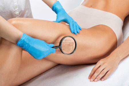 Photo for Epilation, hair removal procedure on a womans body. Beautician doing laser rejuvenation in a beauty salon. Removing unwanted body hair. Hardware ipl cosmetology - Royalty Free Image