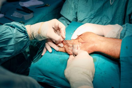 Téléchargez les photos : Les mains d'un chirurgien qualifié, dans des gants stériles, effectuent des sutures précises sur la main d'un patient, mettant en évidence le professionnalisme et la précision des soins de santé dans l'industrie médicale. - en image libre de droit