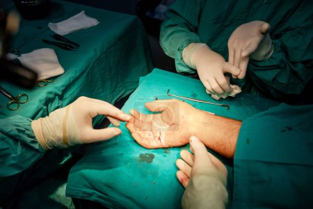 Foto de Manos de cirujano calificado, en guantes estériles, realiza suturas precisas en la mano de un paciente, mostrando la profesionalidad y precisión de la atención médica en la industria médica. - Imagen libre de derechos