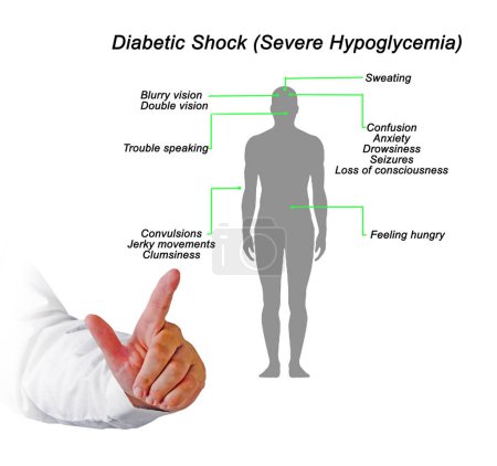 Photo for Diabetic Shock (Severe Hypoglycemia) - Royalty Free Image