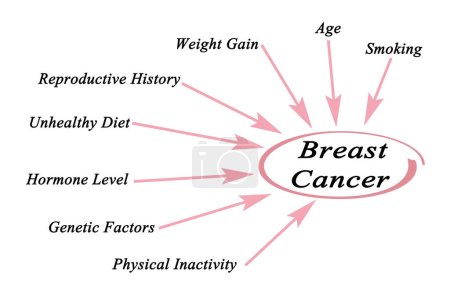 Téléchargez les photos : Facteurs influençant le risque de cancer du sein - en image libre de droit