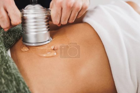 Foto de Mujer irreconocible recibiendo un tratamiento de cavitación por ultrasonido para la reducción de grasa en el abdomen en el salón de belleza. - Imagen libre de derechos