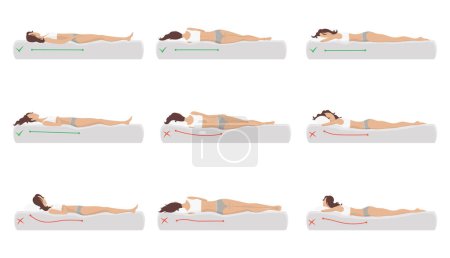 Ilustración de Postura correcta e incorrecta del cuerpo dormido. Espina dorsal en varios colchones y almohada. Cuidar la salud de la espalda, el cuello. Ilustración vectorial comparativa. - Imagen libre de derechos