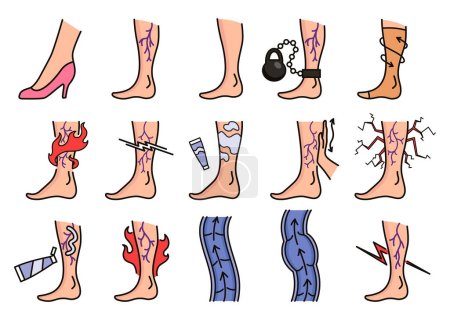 Illustration for Varicose treatment icons set. Violation of circulatory system. Vascular disease diagnostic. Venous insufficiency medical disease. Vector illustration. - Royalty Free Image