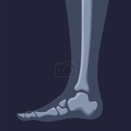 Illustration for Human bones orthopedic and skeleton icon, bone x-ray image of human joints, anatomy skeleton flat design vector illustration. - Royalty Free Image