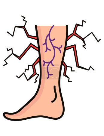 Illustration for Varicose treatment icon. Violation of circulatory system. Vascular disease diagnostic. Venous insufficiency medical disease. Vector illustration. - Royalty Free Image