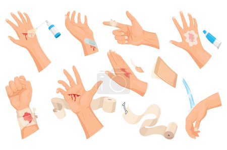 Hands injured skin and procedures of bandaging and wound cleaning. First aid for wound. Medicine cure or treatment. First emergency help for human hand trauma.