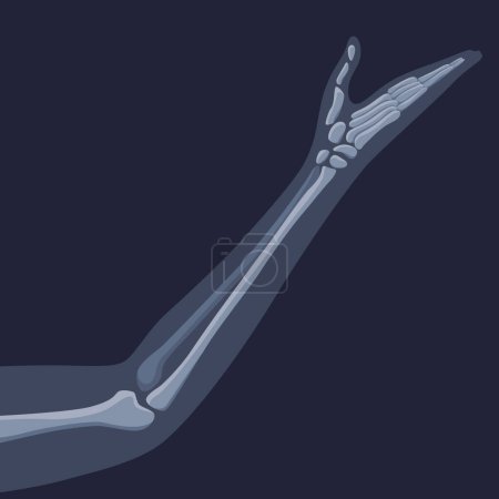 Icône osseuse orthopédique et squelettique humaine, image par radiographie osseuse des articulations humaines, anatomie squelette plat dessin vectoriel illustration.