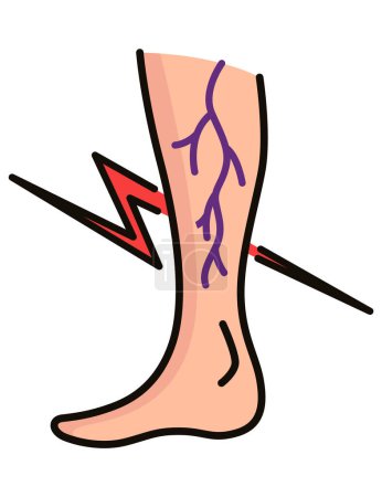 Illustration for Varicose treatment icon. Violation of circulatory system. Vascular disease diagnostic. Venous insufficiency medical disease. Vector illustration. - Royalty Free Image