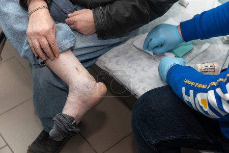 Téléchargez les photos : DONETSK Reg, UKRAINE - Avril 2024 : Un médecin traumatologue de Frida Volunteer Mission examine la jambe d'un homme âgé - en image libre de droit