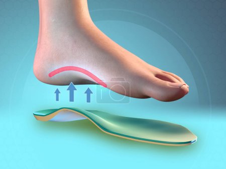 Insole supporting the arch of the foot. Digital illustration, 3D render.