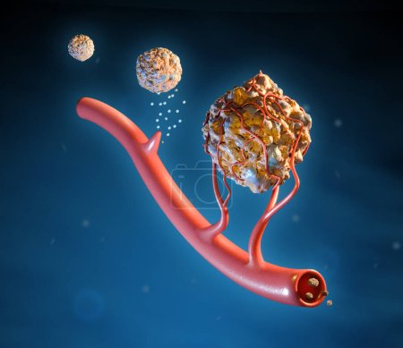 Células cancerosas que utilizan la angiogénesis para crecer y diseminarse por el cuerpo. Ilustración digital, renderizado 3D.