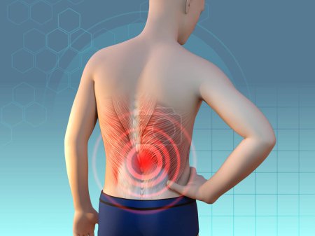 Téléchargez les photos : Douleurs dorsales causées par des problèmes musculaires. Illustration numérique, rendu 3D. - en image libre de droit