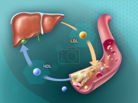 High density and low density lipoproteins adding and removing cholesterol from an arterial plaque. Digital illustration, 3D render.