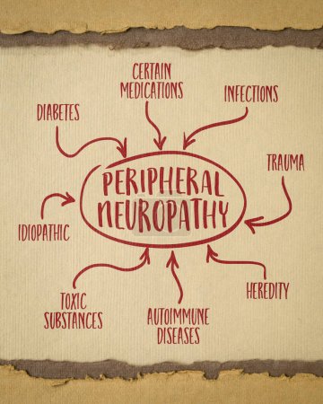 Ursachen der peripheren Neuropathie Infografiken oder Mind-Map-Skizze auf Kunstpapier, Medizin und Heidekonzept