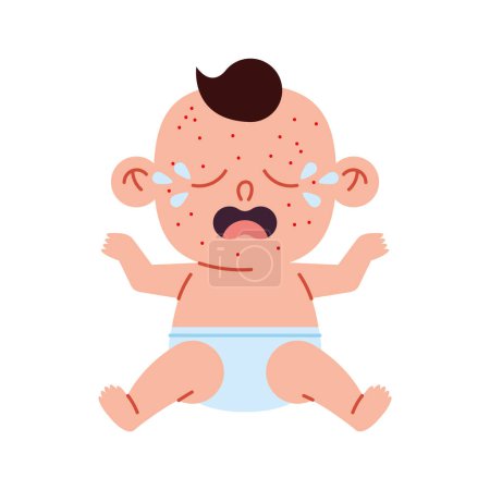 Ilustración de Enfermedad de kawasaki en un vector de bebé aislado - Imagen libre de derechos