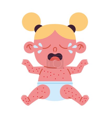 Ilustración de Enfermedad de kawasaki en un vector de bebé niña aislado - Imagen libre de derechos