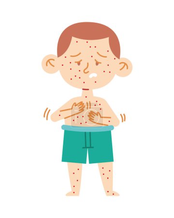 Ilustración de Enfermedad de kawasaki ilustración de un vector de niño enfermo aislado - Imagen libre de derechos