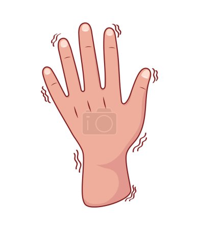 Illustration for Parkinson tremor on the hands isolated - Royalty Free Image