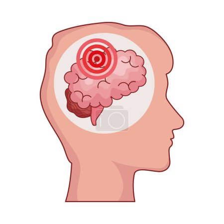 parkinson disease in brain isolated illustration