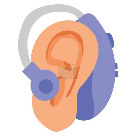 Ilustración de Implante coclear en diseño aislado del oído - Imagen libre de derechos