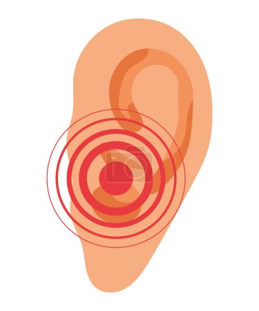 Illustration for Cochlear implant waves sound isolated - Royalty Free Image