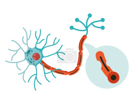 Illustration for Parkinson neural disease illustration vector - Royalty Free Image