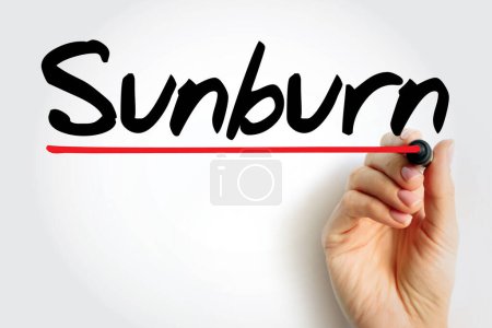 Téléchargez les photos : Sunburn is a form of radiation burn that affects living tissue, such as skin, text concept background - en image libre de droit
