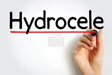 Photo for Hydrocele is a type of swelling in the scrotum that occurs when fluid collects in the thin sheath surrounding a testicle, text concept for presentations and reports - Royalty Free Image