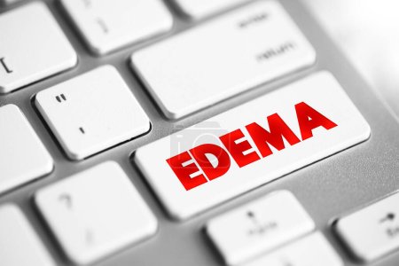 Edema is swelling caused by excess fluid trapped in your body's tissues, text concept button on keyboard