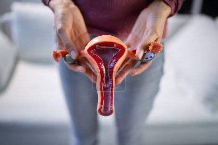 Téléchargez les photos : Diaphragme Anneau contraceptif vaginal. Contraception au spermicide et contraception - en image libre de droit