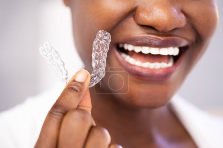 Clear Aligner Dental Night Guard für Zähne